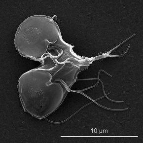 Microscopia de Giardia lamblia