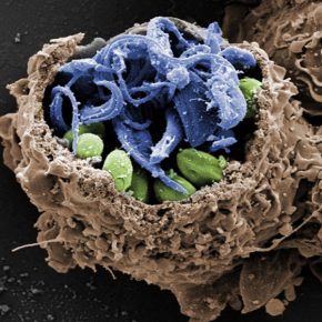 Leishmania e Trypanosoma cruzi