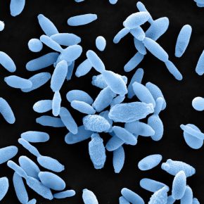 Microscopia de Sporothrix